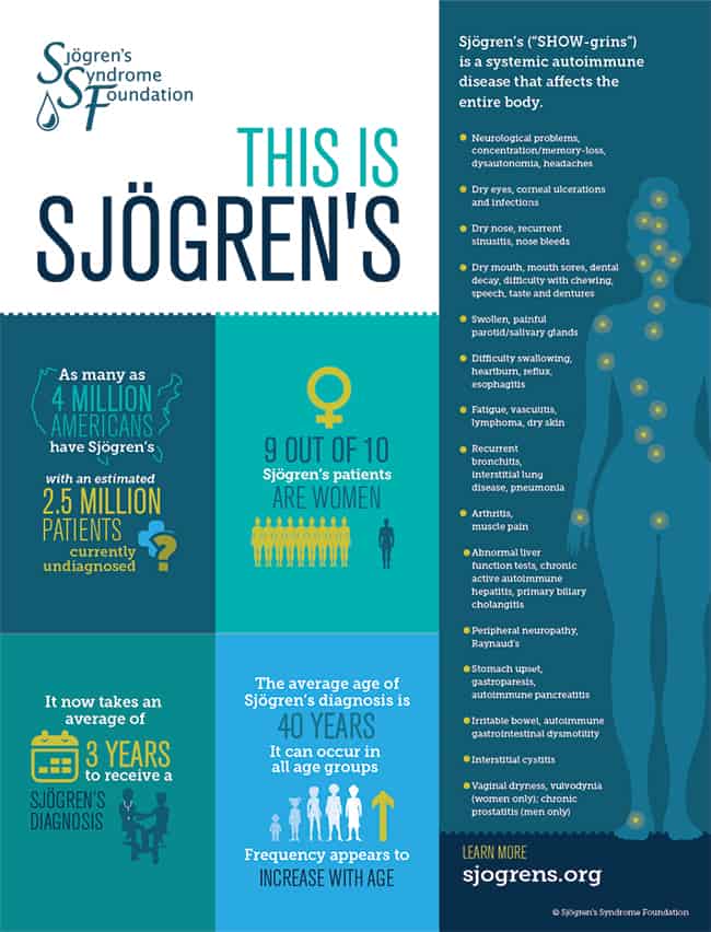 Symptoms and statistics of Sjogren’s Syndrome