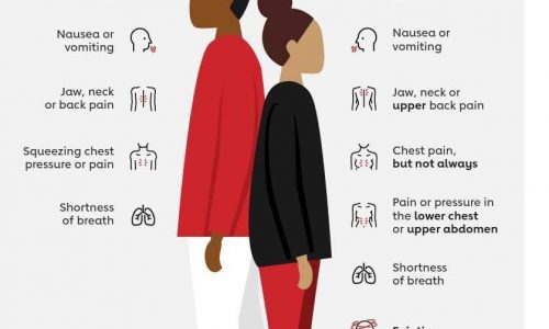 Men vs Women's Heart Attack Symptoms